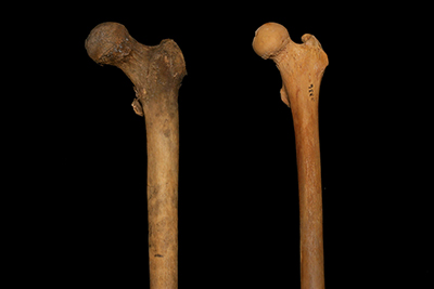 Photo of two left femurs from the front
