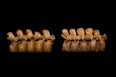 Photo of lumbar vertebrae